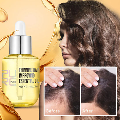 PURC Ginger Hair Growth Oil